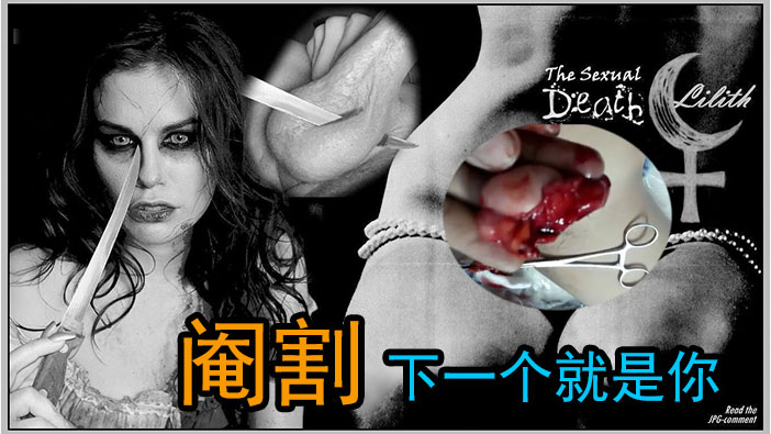 【另类刺激】缅甸蛋蛋切割，男的别进来小心下一个就轮到你